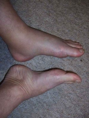 Ankle 2i.jpg