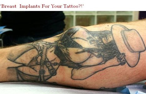 TATTOO IMPLANT 1.jpg