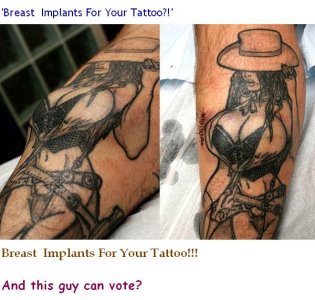 TATTOO IMPLANT 2.jpg