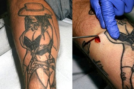 TATTOO IMPLANT.jpg